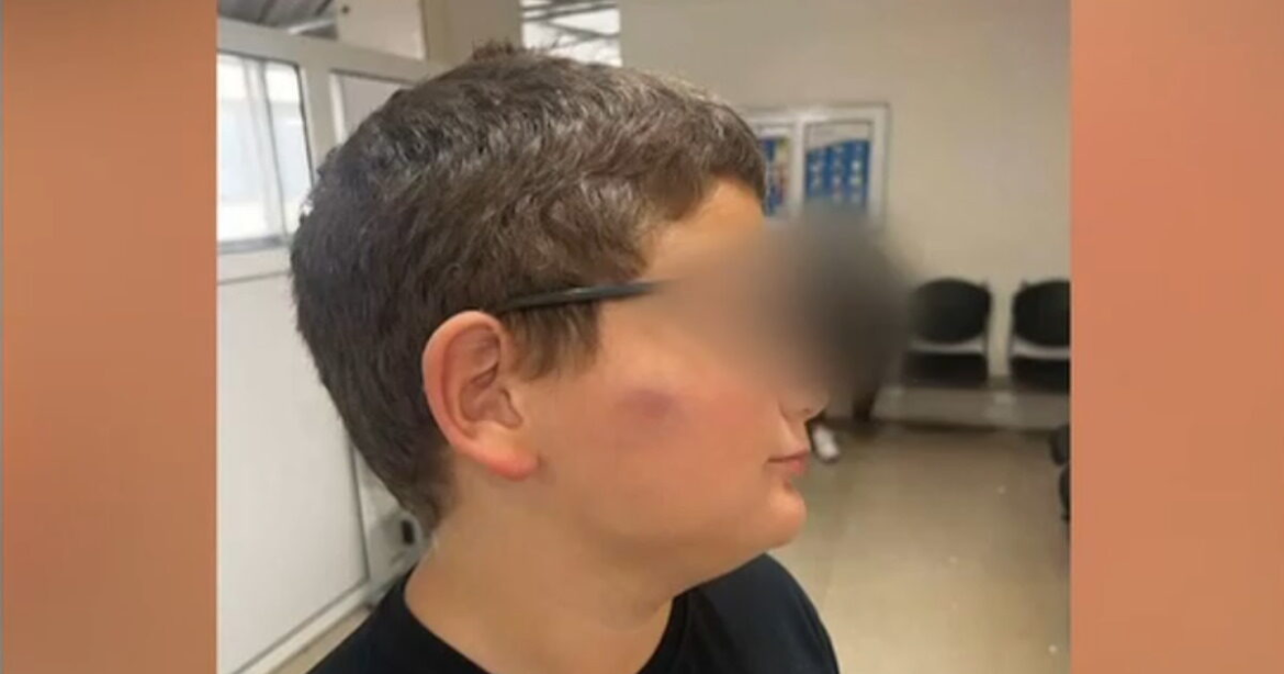 Θεσσαλονίκη: «Δεν θα στείλω ακόμα τον γιο μου στο σχολείο» λέει η μητέρα του 11χρονου που ξυλοκοπήθηκε από συμμαθητές του