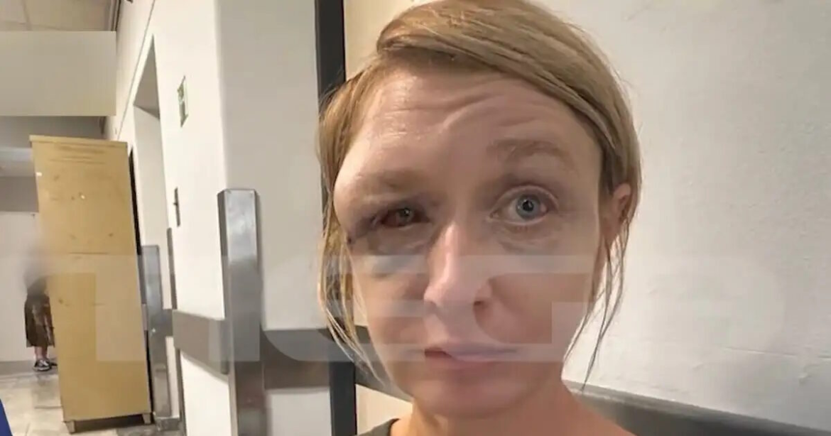 Κορωπί: «Είναι σε τραγική κατάσταση» λέει η μητέρα της 40χρονης μετά τον άγριο ξυλοδαρμό – «Θα την πάρω πίσω στη Λιθουανία»